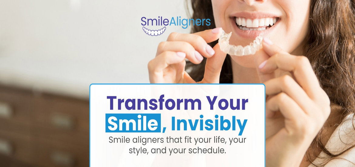 Smile Aligners